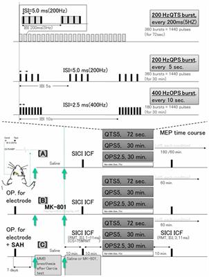 Blockade of Motor Cortical Long-Term Potentiation Induction by Glutamatergic Dysfunction Causes Abnormal Neurobehavior in an Experimental Subarachnoid Hemorrhage Model